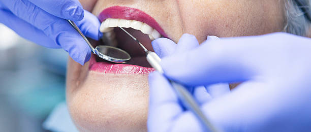 Best Knocked-Out Tooth Emergency  in Mount Olive, IL